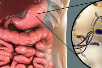 Helicobacter pylori